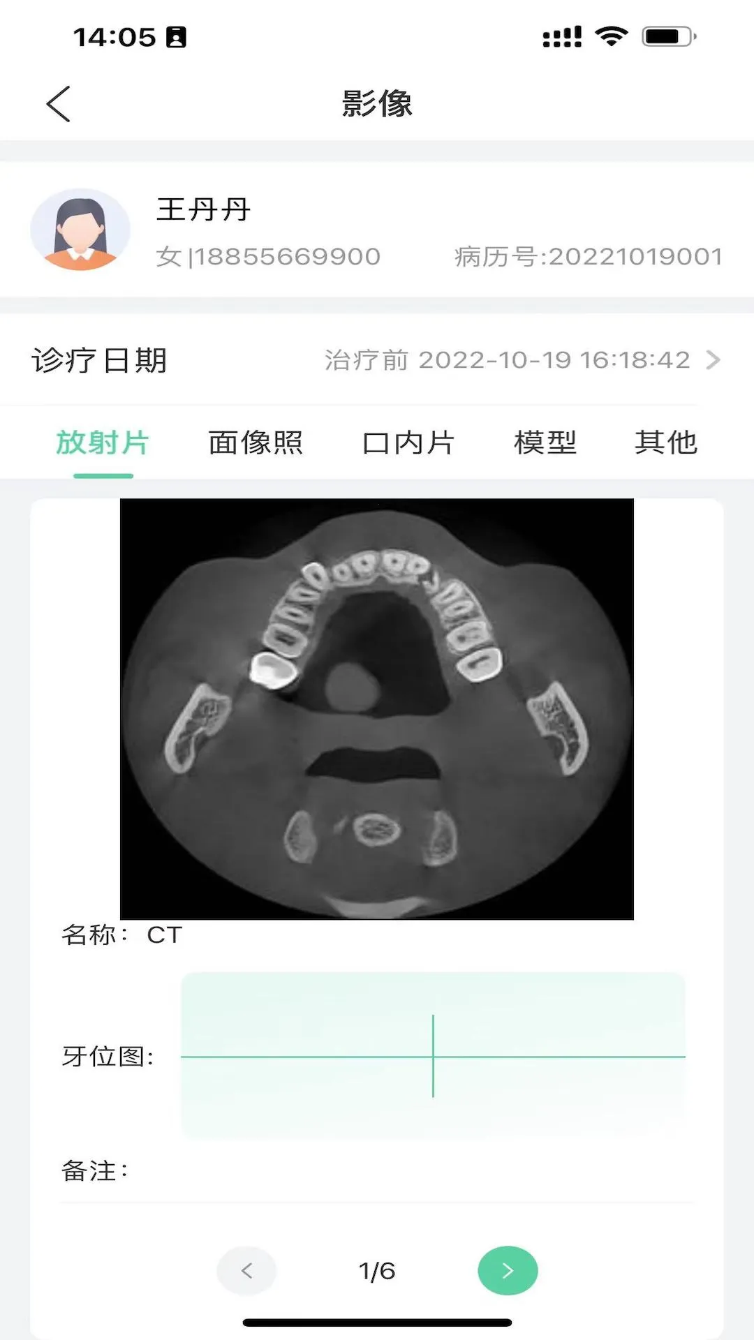 ��������v0.1.0 �ֻ���