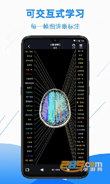 影像解剖图谱最新手机版 影像解剖图谱最新手机版